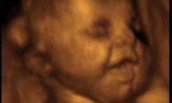 London's original & leading 3D Clinic~~ 3D BabyVision Fetal Imaging is London's premier provider of 3D Ultrasound services.  A fetal imaging centre that offers parents-to-be an opportunity to view their baby and capture the greatest of life's moments